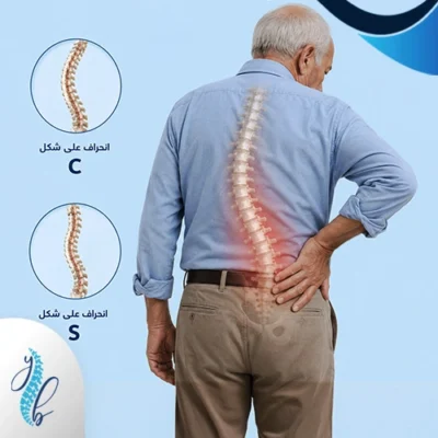 علاج اعوجاج العمود الفقري عند الكبار 