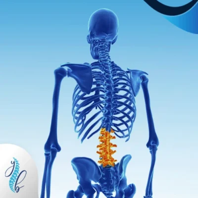 أعراض اعوجاج العمود الفقري