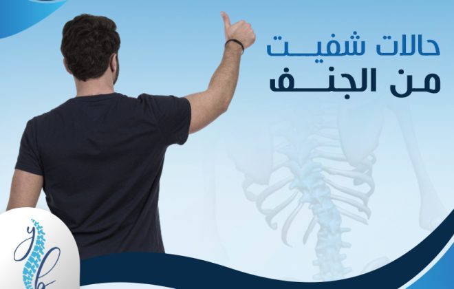 حالات شفيت من الجنف