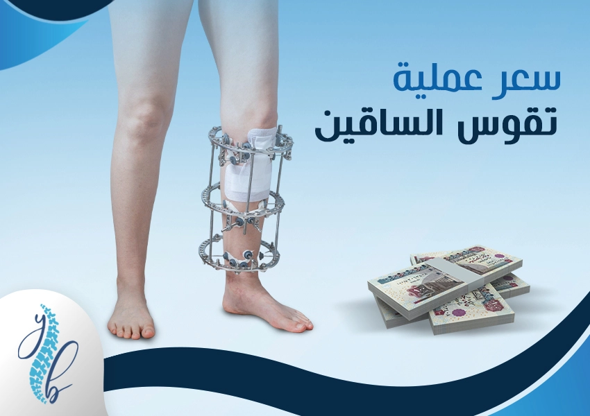 سعر عملية تقوس الساقين