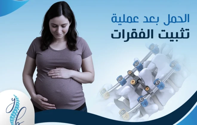 الحمل بعد عملية تثبيت الفقرات