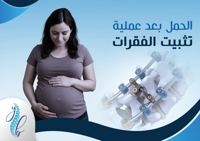 الحمل بعد عملية تثبيت الفقرات