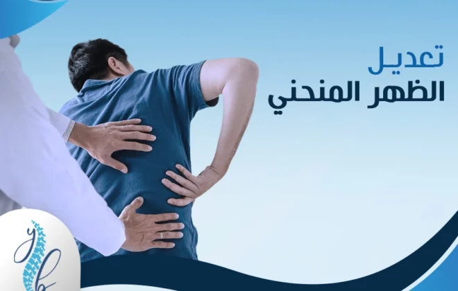 تعديل الظهر المنحني