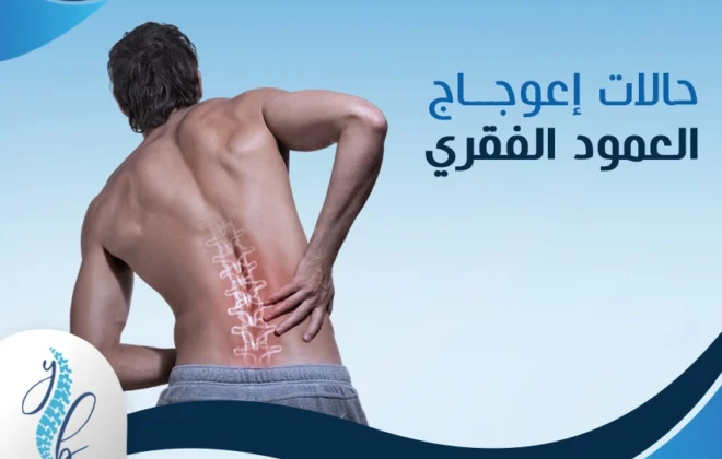 حالات اعوجاج العمود الفقري