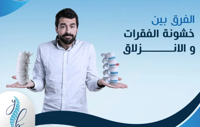الفرق بين خشونة الفقرات والانزلاق