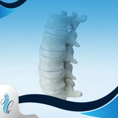الفرق بين خشونة الفقرات والانزلاق 