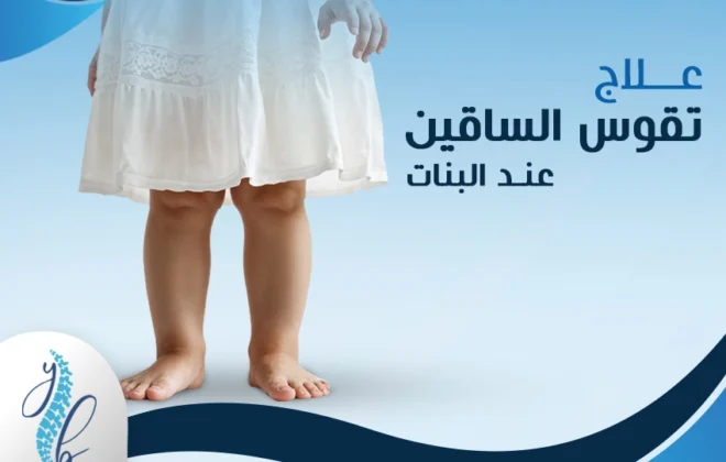 علاج تقوس الساقين عند البنات