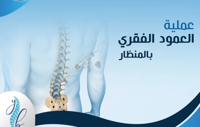 عملية العمود الفقري بالمنظار