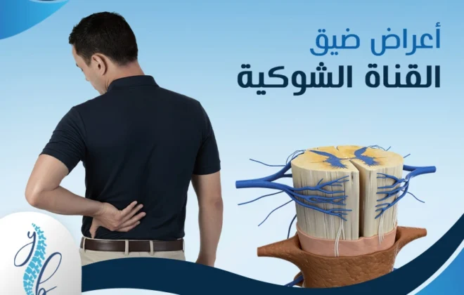 أعراض ضيق القناة الشوكية