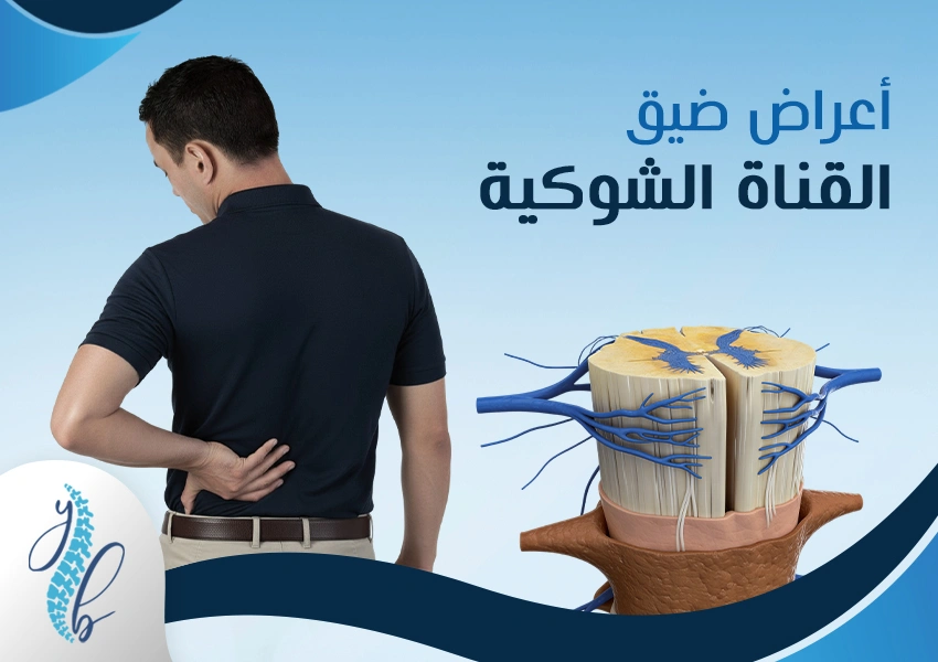 أعراض ضيق القناة الشوكية