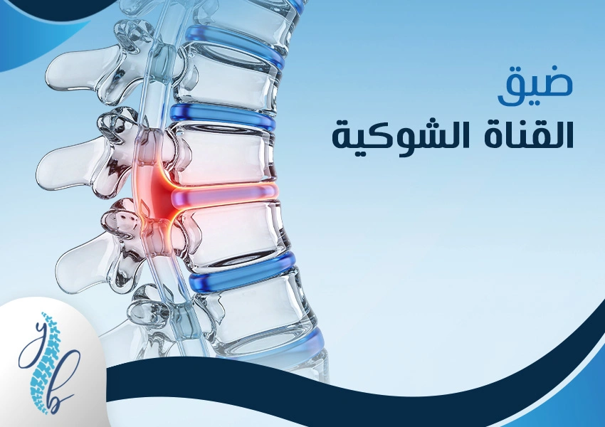 ضيق القناة الشوكية ضيق القناة الشوكية