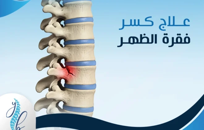 علاج كسر فقرة الظهر