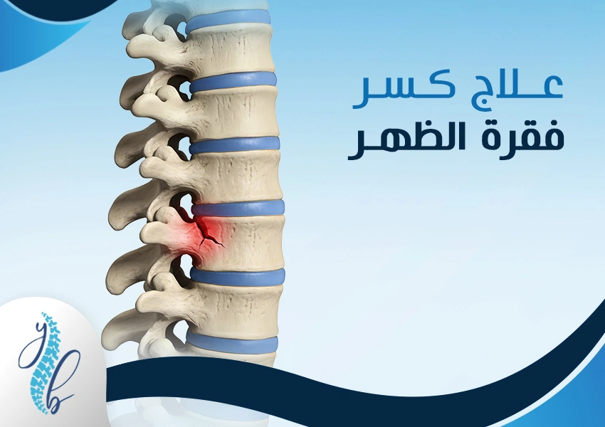 علاج كسر فقرة الظهر