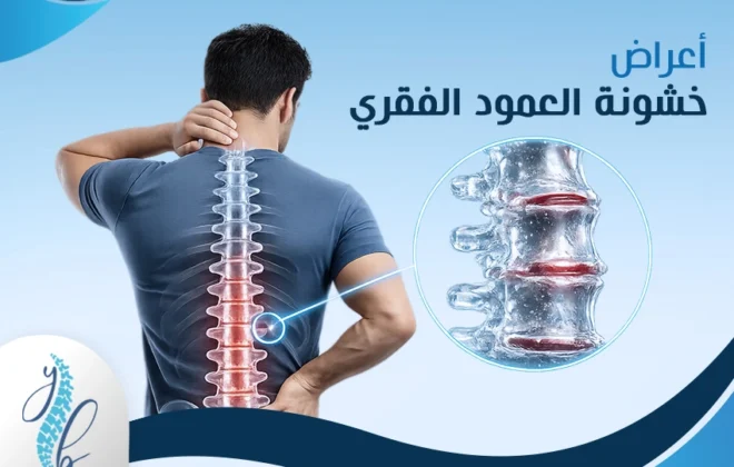 أعراض خشونة العمود الفقري
