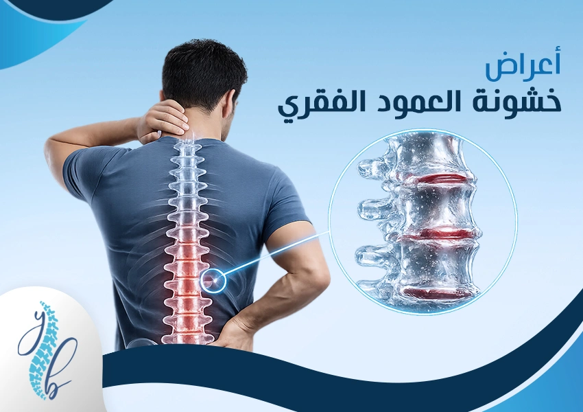 أعراض خشونة العمود الفقري