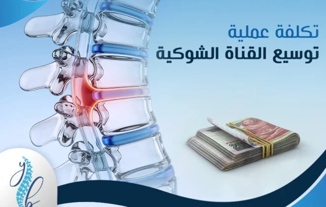 تكلفة عملية توسيع القناة الشوكية