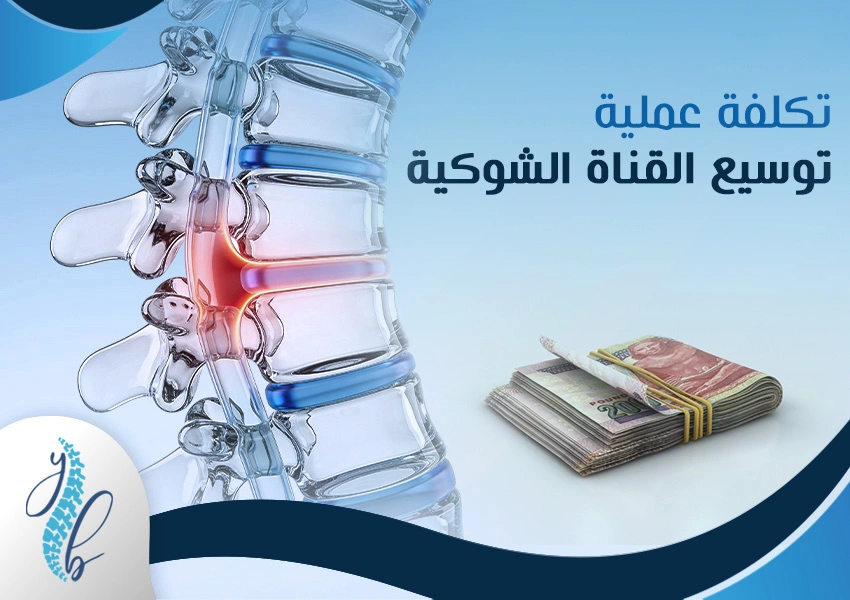 تكلفة-عمليه-توسيع-القناة-الشوكية تكلفة عملية توسيع القناة الشوكية