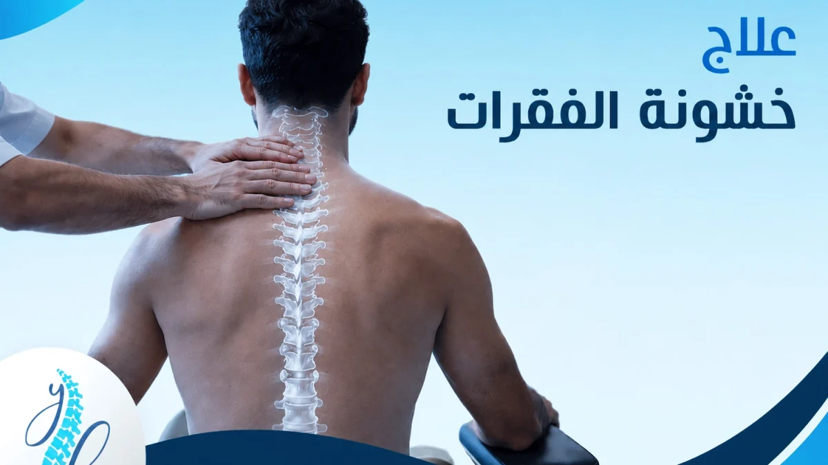 علاج خشونة الفقرات