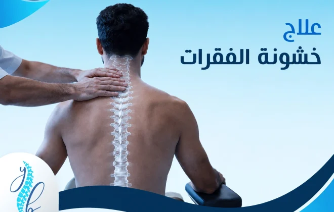 علاج خشونة الفقرات