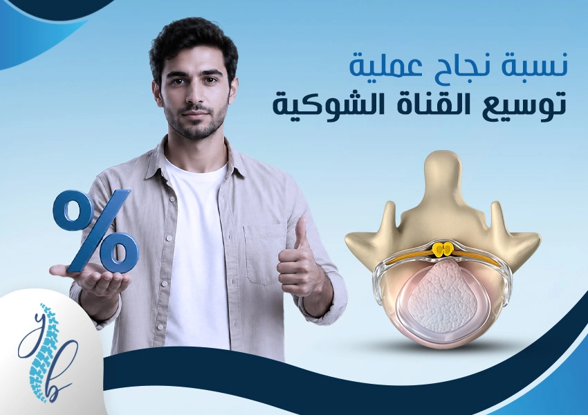 نسبة نجاح عملية توسيع القناة العصبية نسبة نجاح عملية توسيع القناة العصبية